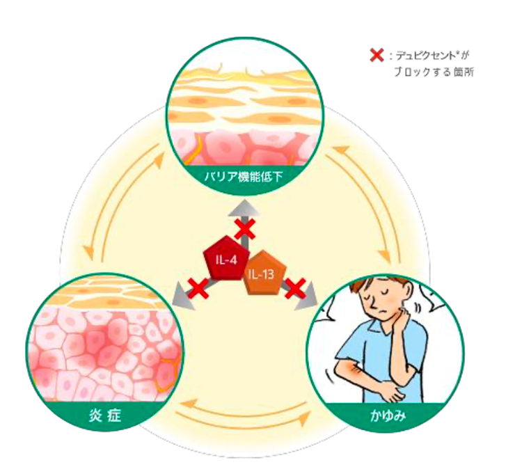 デュピクセントの作用